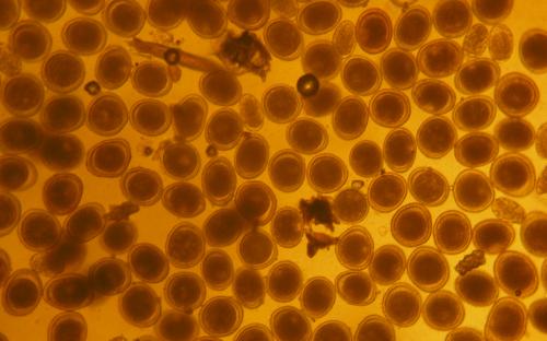 ПАРАЗИТОЗИ БЕЗПРИТУЛЬНИХ СОБАК